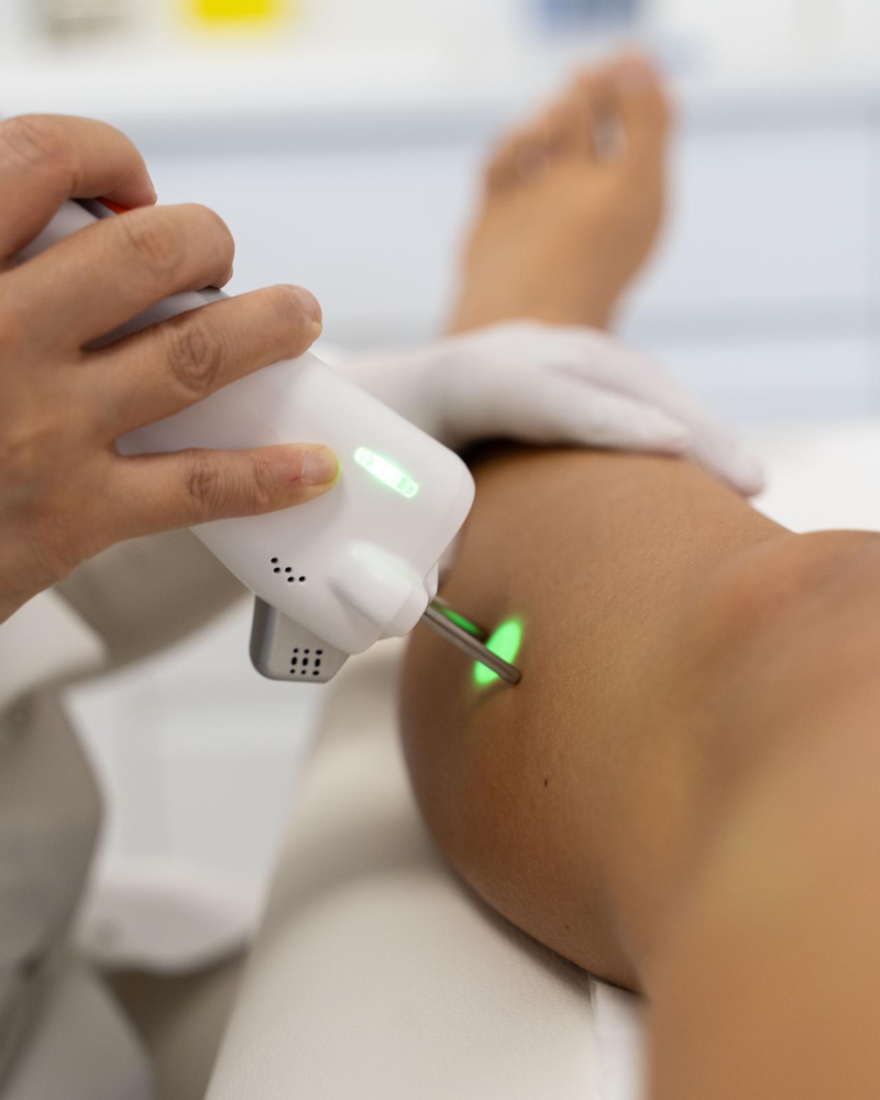 Épilation Laser Médicale à Nice : Expertise & Technologie Clarity II™